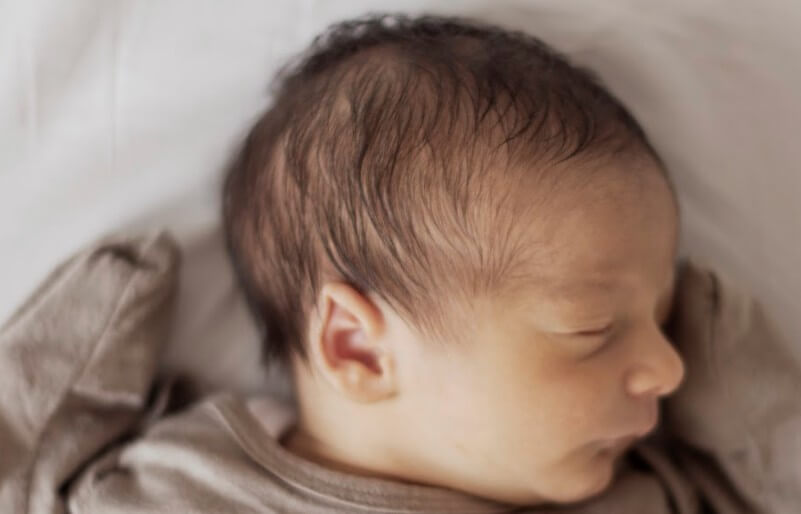 laposfejűség: Laposfejű baba fejforma a háton fekvés miatt